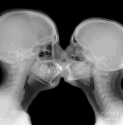 x-ray-of-a-couple-kissing-guy-viner